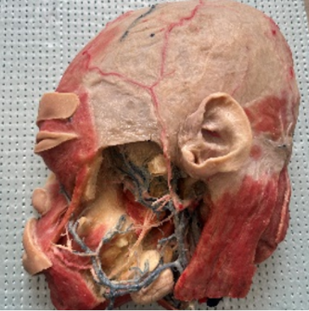 Bluebay®The whole visceral specimen Male with Organ Head, Breast, Eyeball, Heart