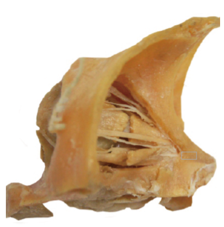 Bluebay®The whole visceral specimen Male with Organ Head, Breast, Eyeball, Heart